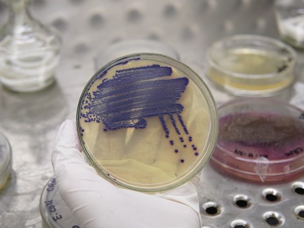 Microbiology Testing